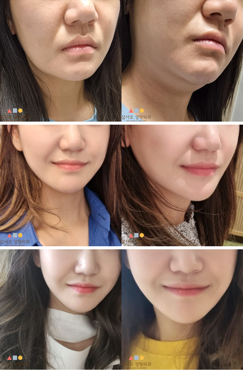 d9d39f8a5402ba12153a1bae9e5971c6_1693384277_3172.png d9d39f8a5402ba12153a1bae9e5971c6_1693384277_3172.png