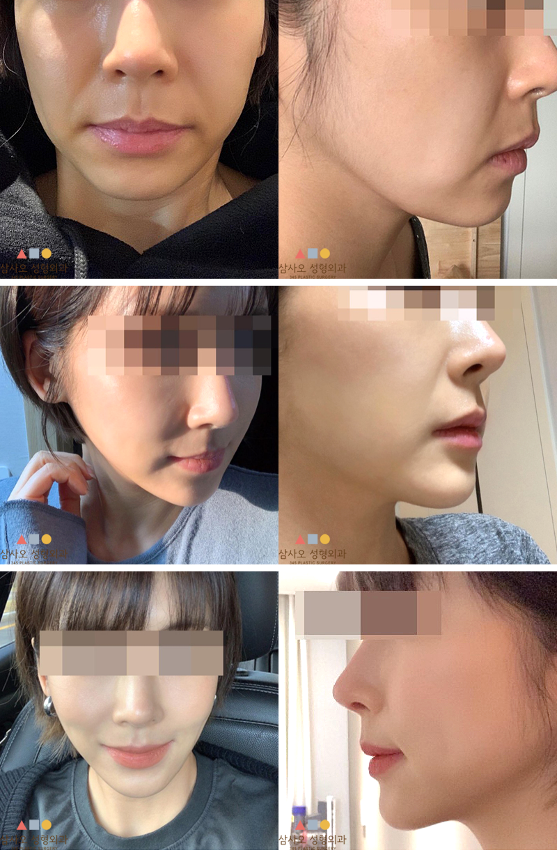 dbf7e542067b8761000312fbd986a2bb_1692590006_1189.png dbf7e542067b8761000312fbd986a2bb_1692590006_1189.png