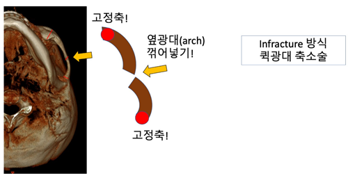 db51d8e9bfc8668b3ddc3d60d1b734a8_1765780237_7631.PNG