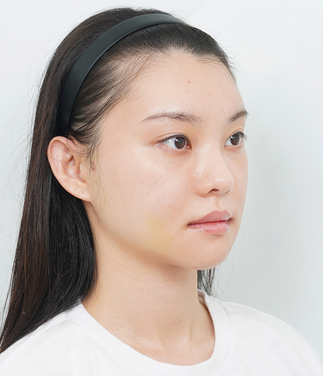 45도 After