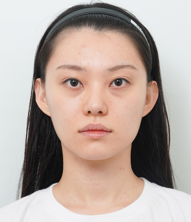 정면 Before