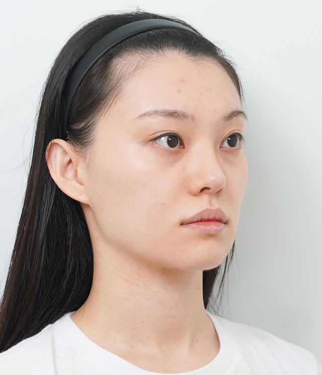 45도 Before