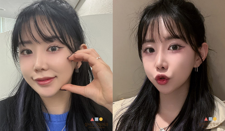수술 후
