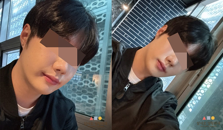 수술 후