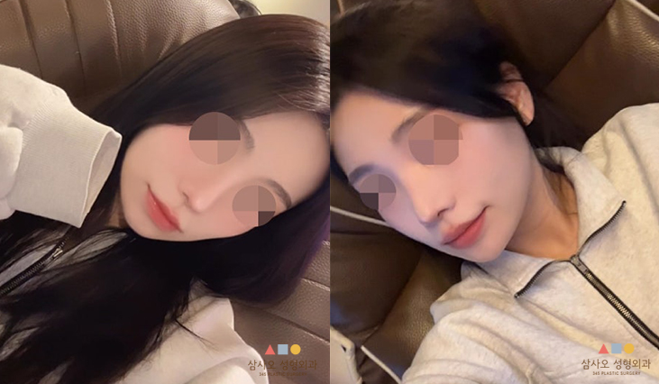 수술 후