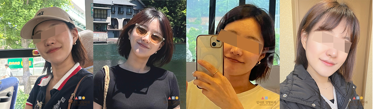 수술 후