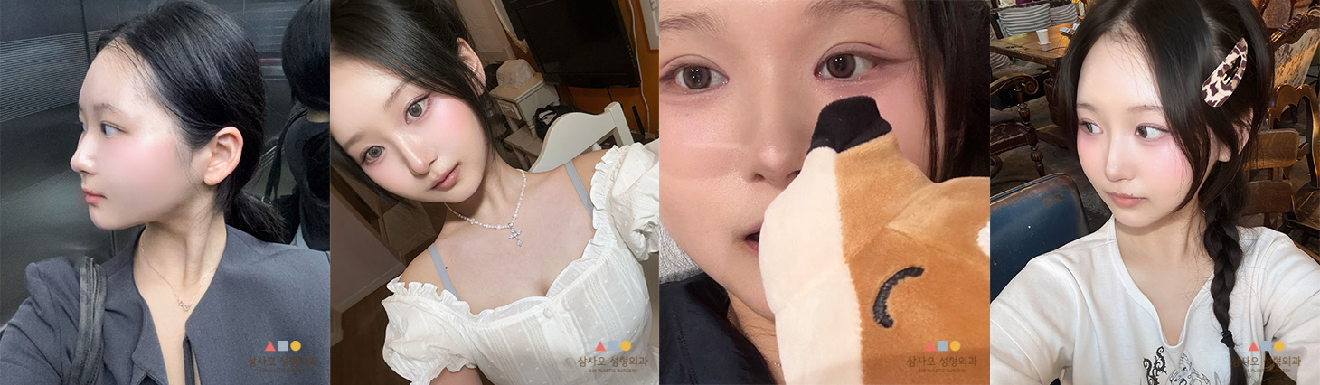 수술 후