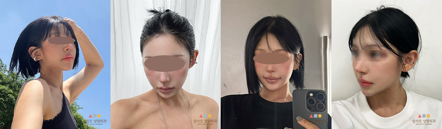 수술 후