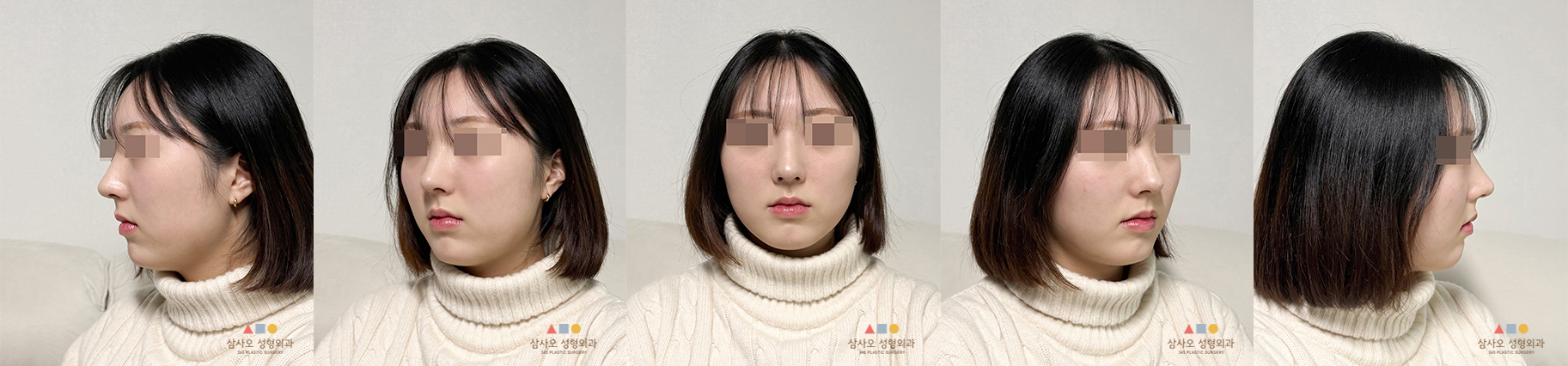 수술 후