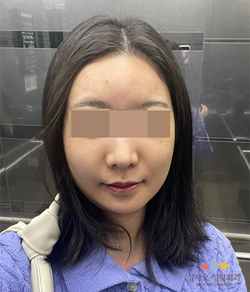 수술 후