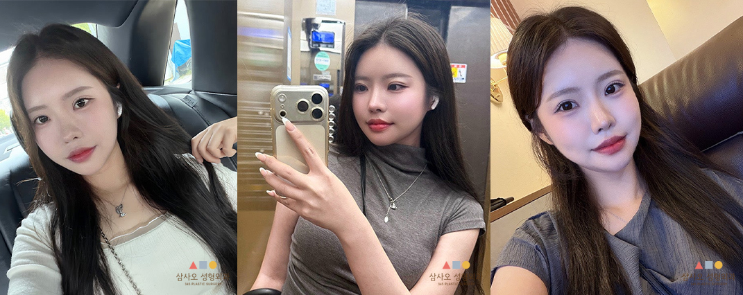 수술 후