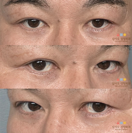 2개월차