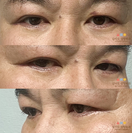 2주차