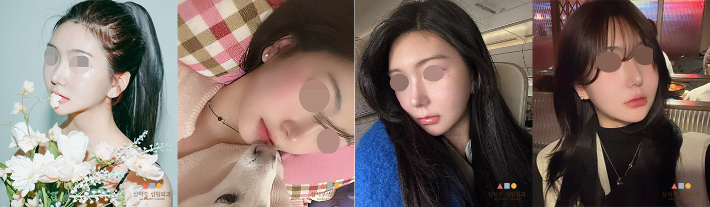 수술 후