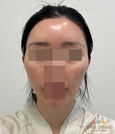 수술 전