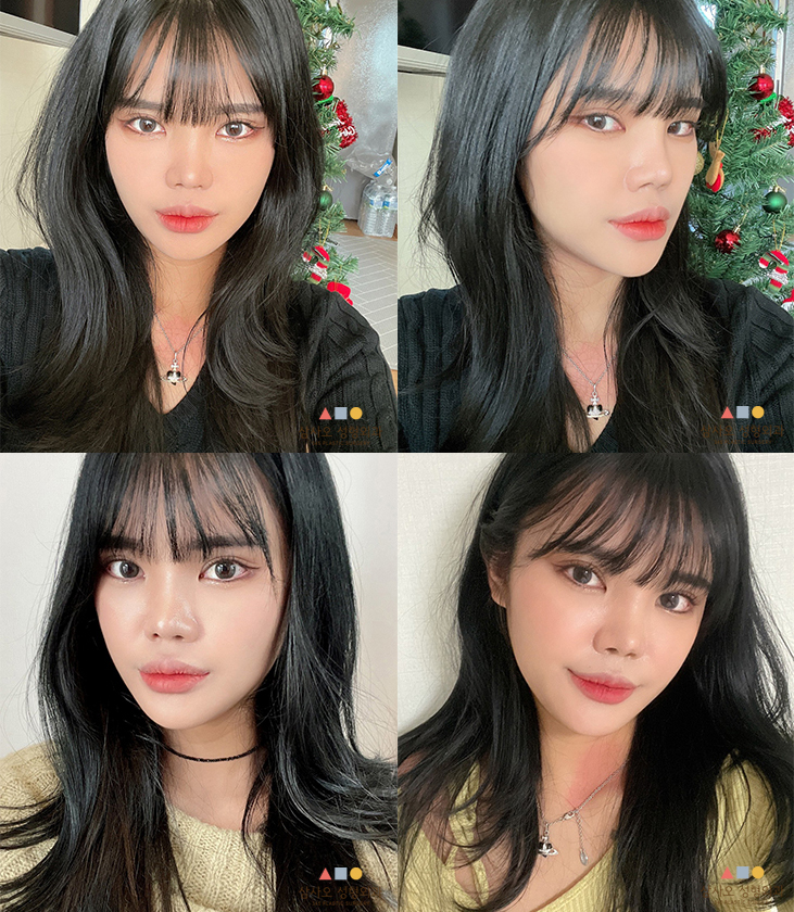 수술 후