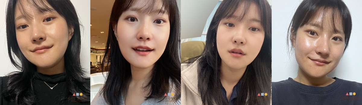 수술 후