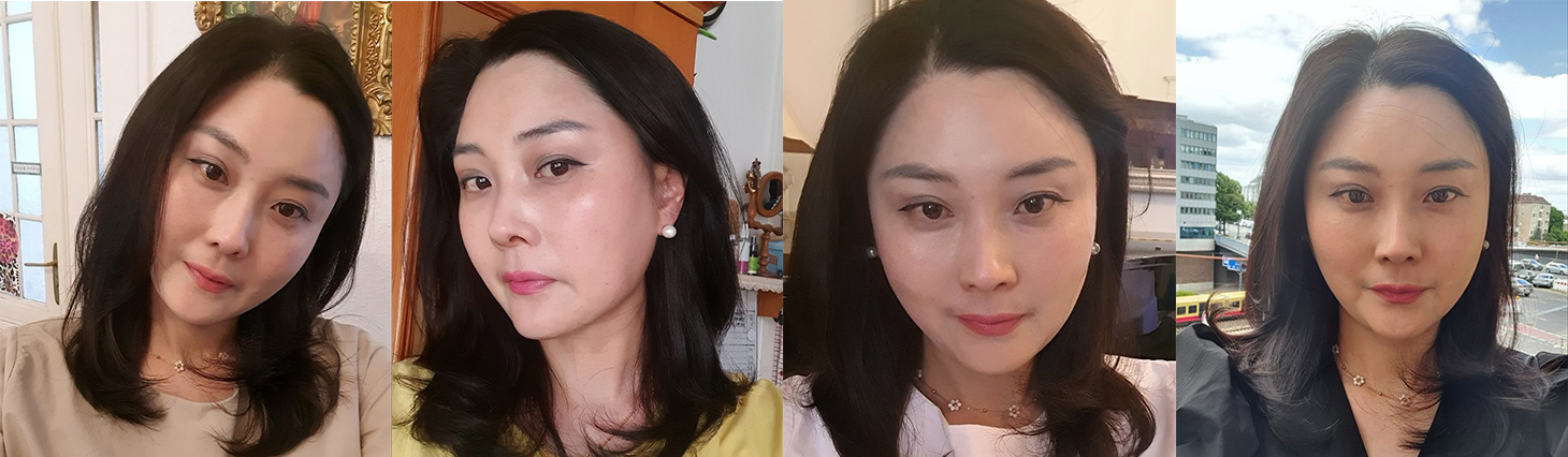 수술 후