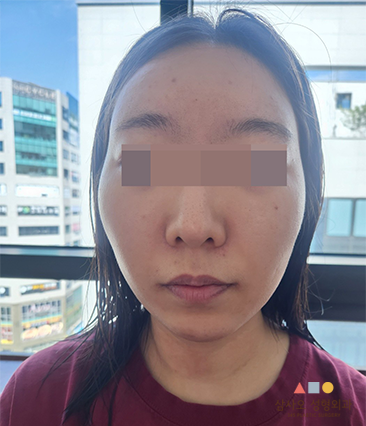 수술 전
