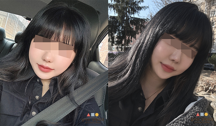 수술 후