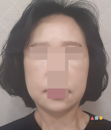 수술 후