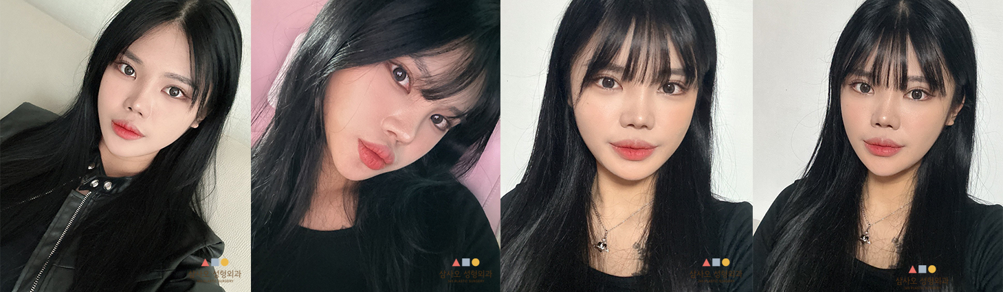 수술 후