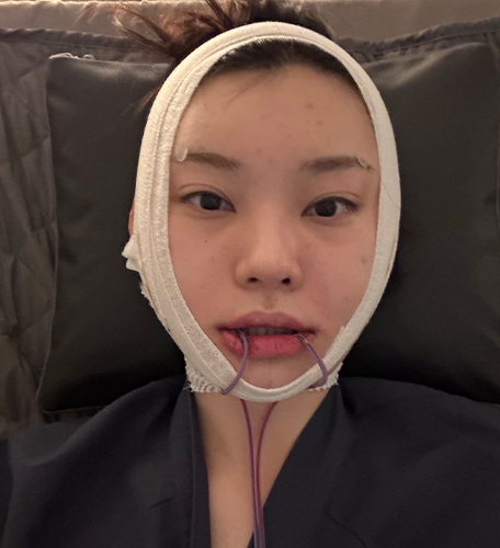 수술 당일