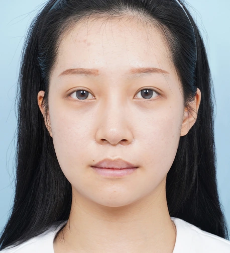 정면 13일 후