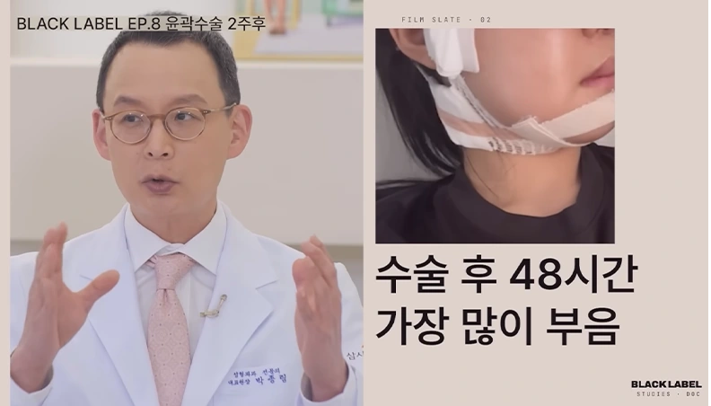 회복 과정 설명 2