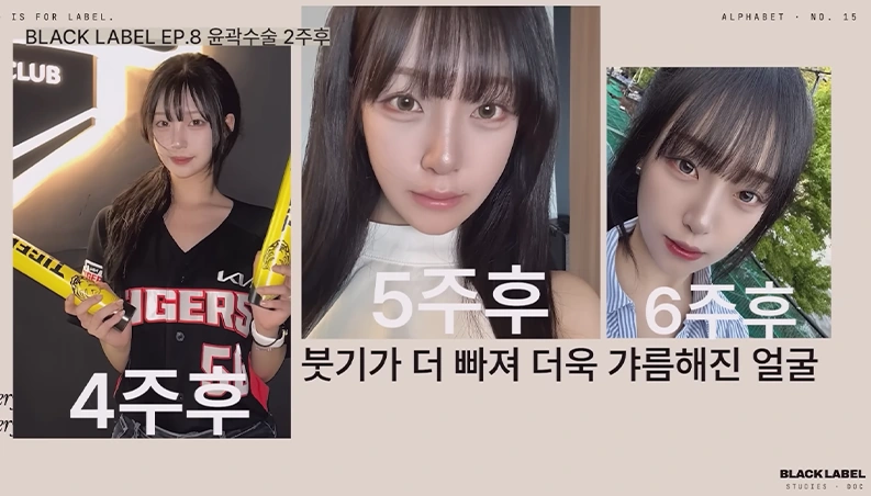 회복 과정 설명 4