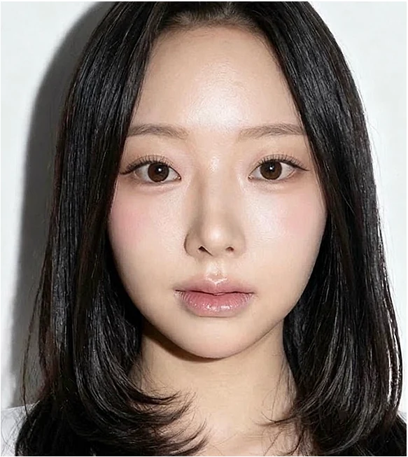 수술 30일 후
