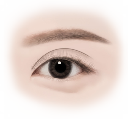 BEFORE 이미지