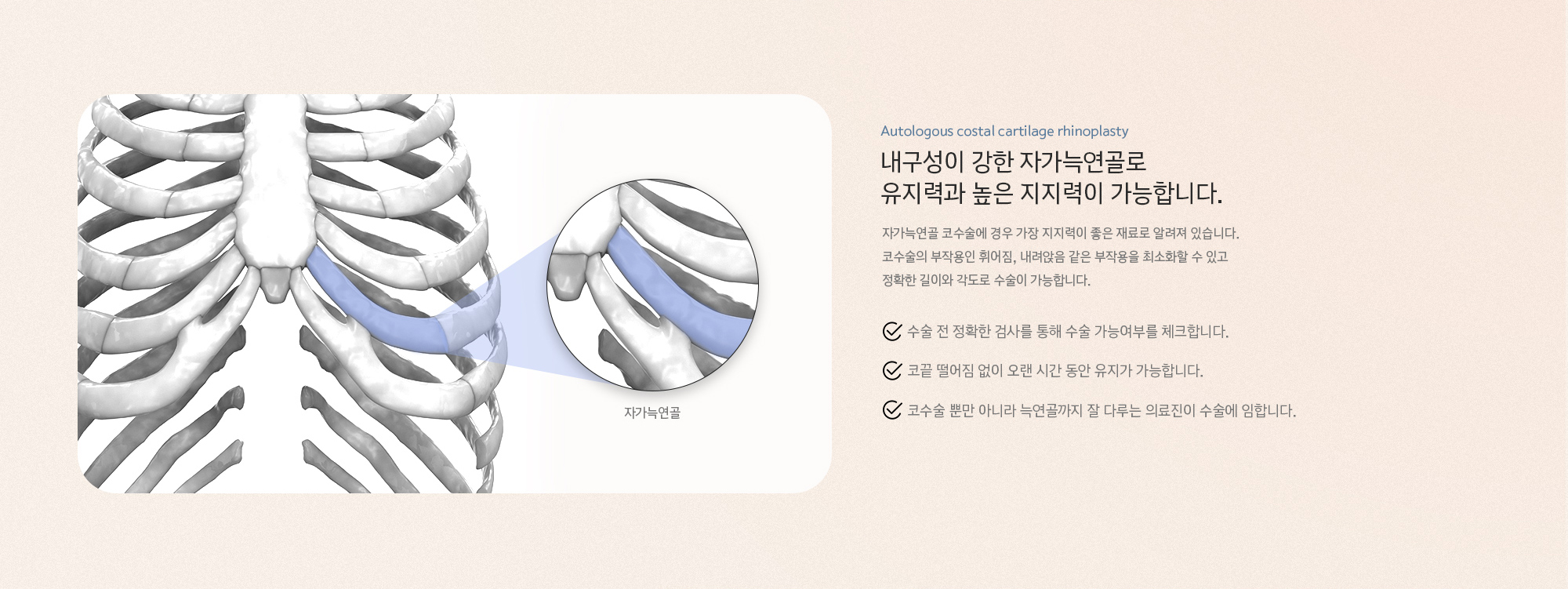 내구성이 강한 자가늑연골로 유지력과 높은 지지력이 가능합니다. 자가늑연골 코수술에 경우 가장 지지력이 좋은 재료로 알려져 있습니다. 코수술의 부작용인 휘어짐, 내려앉음 같은 부작용을 최소화할 수 있고 정확한 길이와 각도로 수술이 가능합니다.