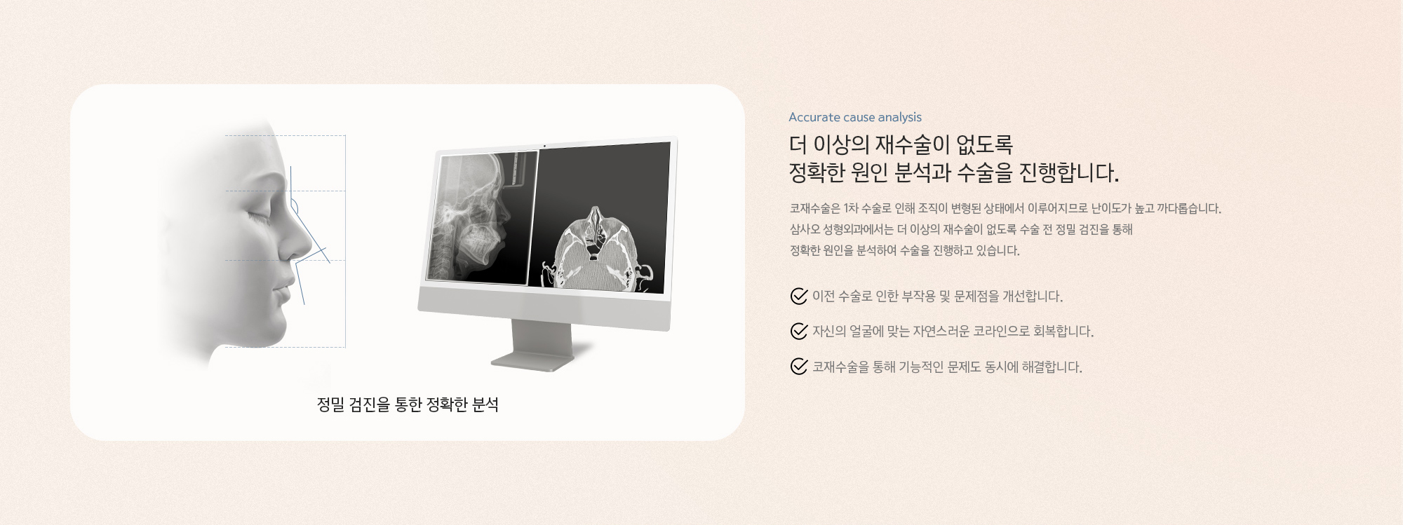 더 이상의 재수술이 없도록 정확한 원인 분석과 수술을 진행합니다. 코재수술은 1차 수술로 인해 조직이 변형된 상태에서 이루어지므로 난이도가 높고 까다롭습니다. 삼사오 성형외과에서는 더 이상의 재수술이 없도록 수술 전 정밀 검진을 통해 정확한 원인을 분석하여 수술을 진행하고 있습니다.